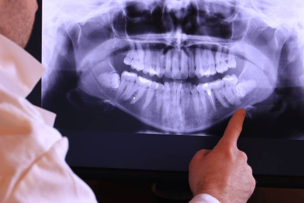 Best Weekend Emergency Dentist in Emerd Mountain, AL
