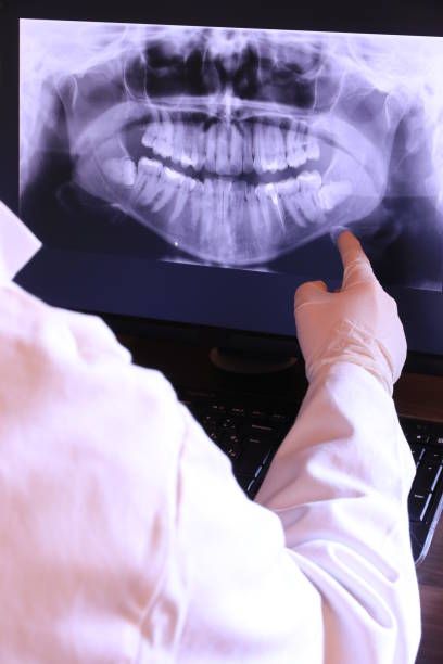 Best Walk-In Emergency Dentist in Emerd Mountain, AL