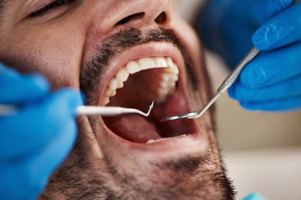 Best Emergency Broken Tooth Repair in Emerd Mountain, AL